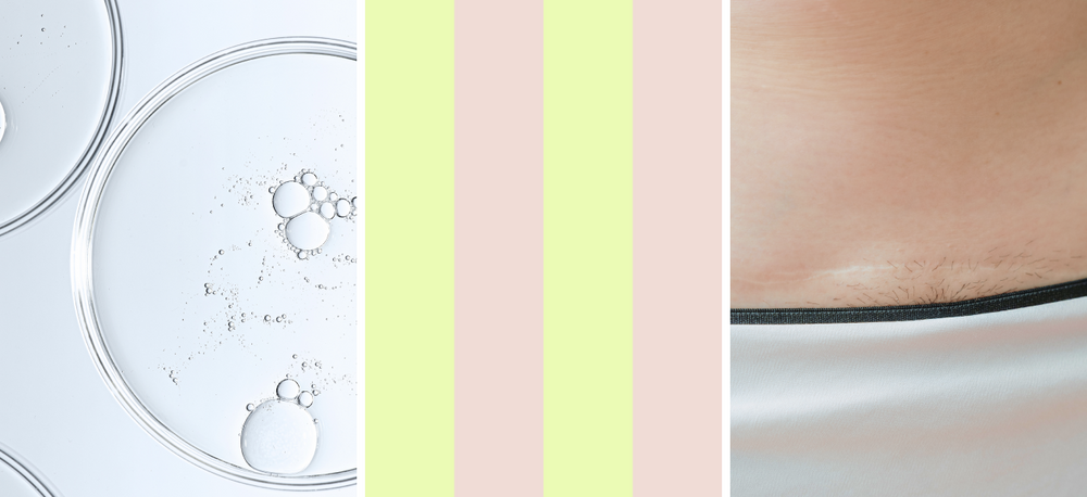 Produktion der Healyni Narbencreme in Deutschland, GMP-konform nach ISO 22716